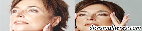 Dicas para se prevenir das malditas rugas