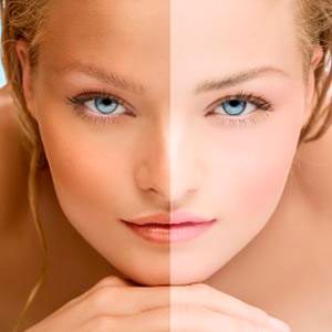 TRATAMENTO COM CREME